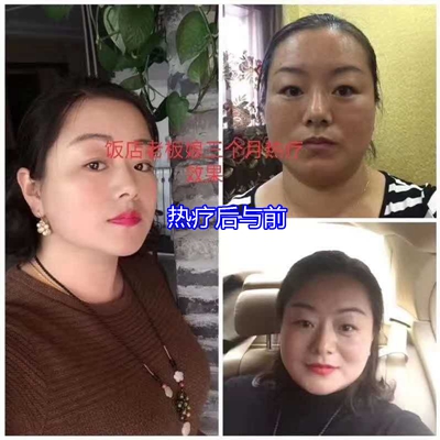 顾客反映：在睡吧热疗让自己变美了（四）
